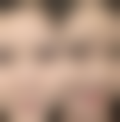 【甘肃省人民医院(整形美容外科)怎么预约挂号?】