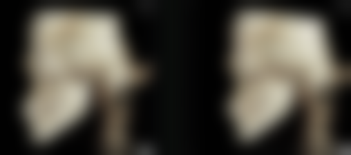 丰太阳穴的注意事项