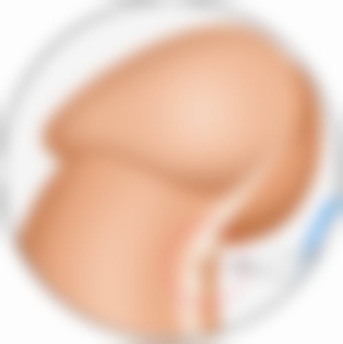 打瘦脸针会有什么副作用？揭秘3大常见副作用及5种有效应对方法，让你安全变美！ 