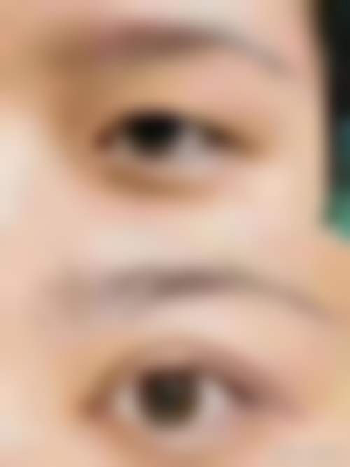 韩国PROPOSE整形医院