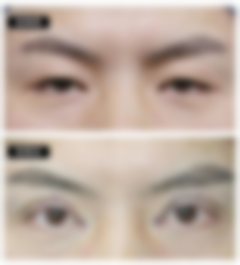 【辽阳燕丽整形医院是正规的吗?】