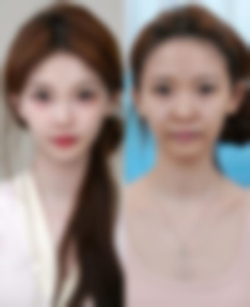 【吴万强医生擅长项目】