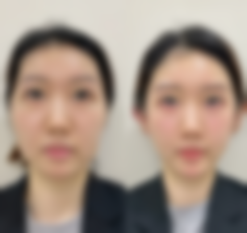 【泉州亿星整形美容医院患者口碑评价：】