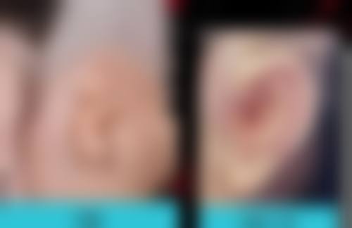 海内外上有四种莓 草莓 树莓 蔓越莓 还有一种是什么