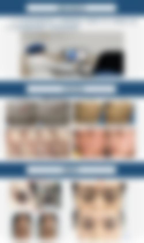 【彝良县颜熹整形医院患者口碑评价：】