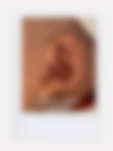 【彝良县颜熹整形医院是正规的吗?】