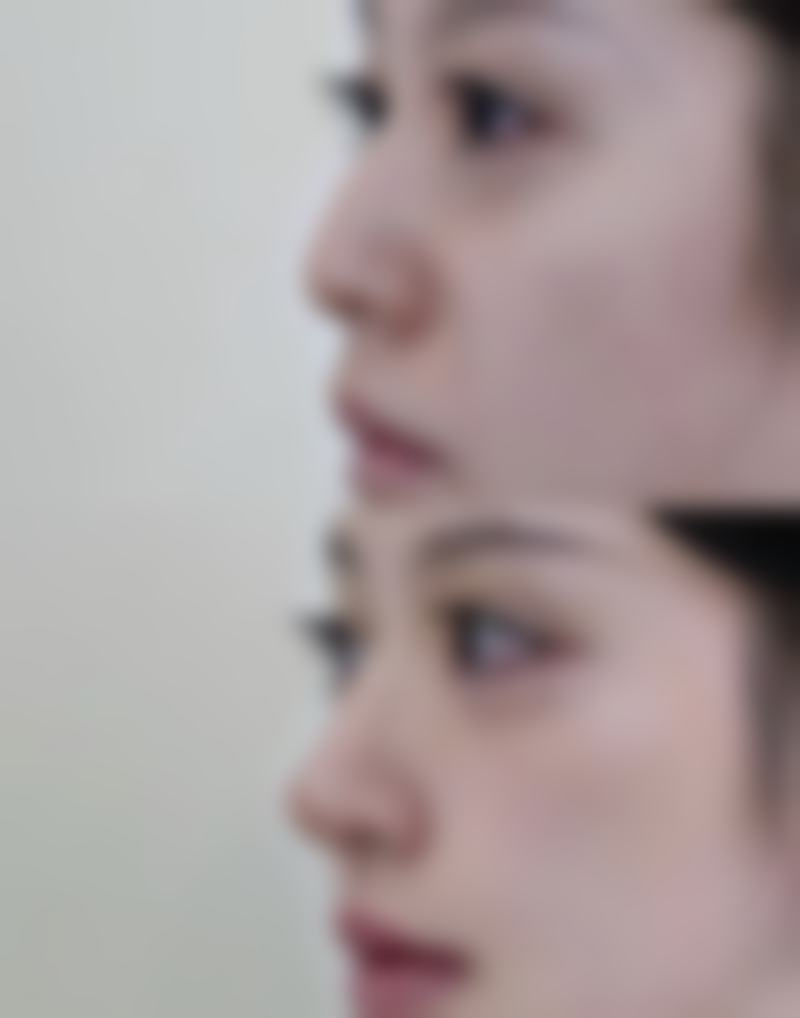 黄岛区宋秀娥和张宇恒谁更适合医美顾客