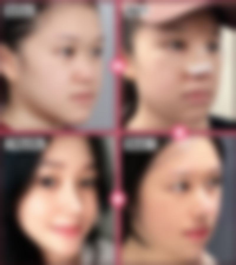 【肇庆民和医院嘉宝激光整形诊疗设备：】