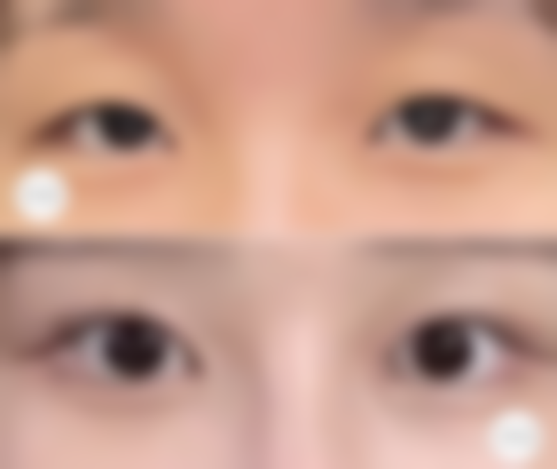 【阳春星璨医疗美容门诊部诊疗设备：】