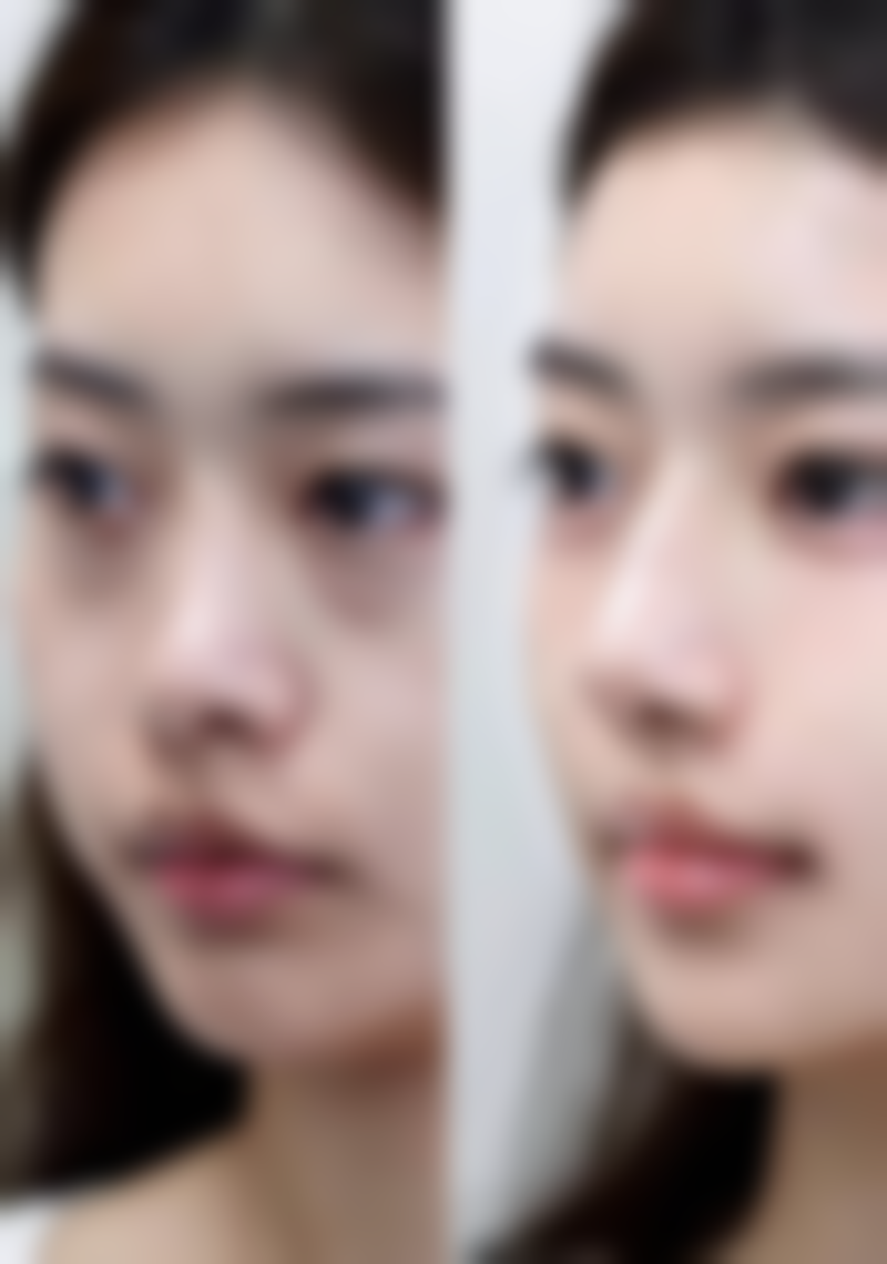 种植头发的成效能保持多久