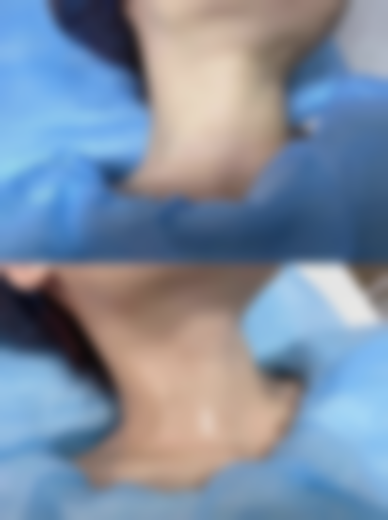 【吴成安医生口碑】