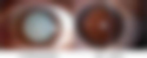 生完宝宝可以做阴道紧缩术吗？了解手术原理、恢复周期与效果，助你重拾产后紧致生活！ 