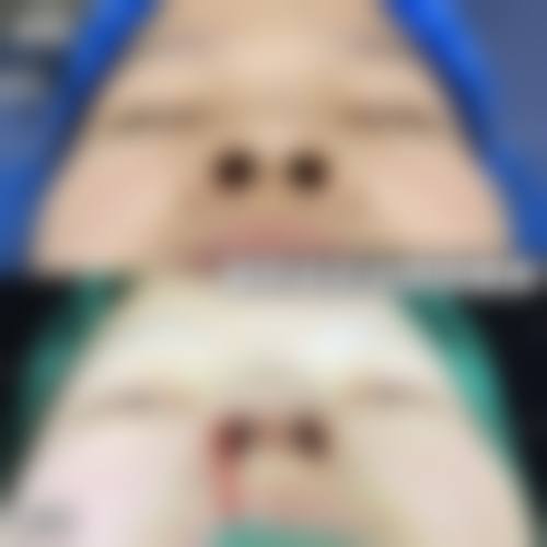 【成都维蜜医美参考价格表】