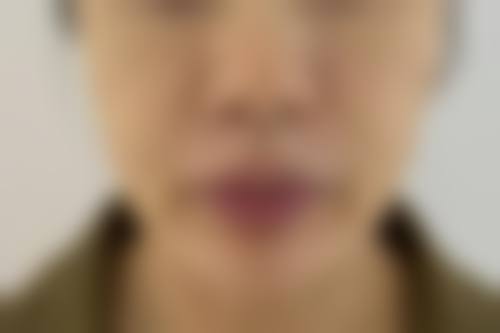 【景洪普惠医院整形美容中 心参考价格表：】