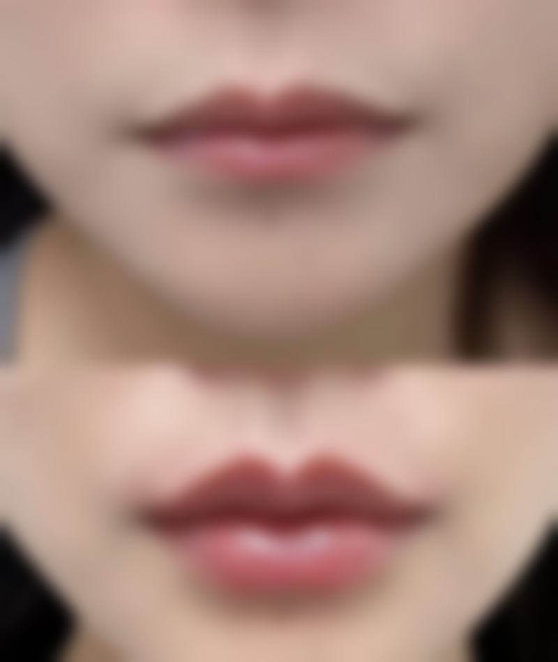 【揭阳华美整形美容医院特色项目：】