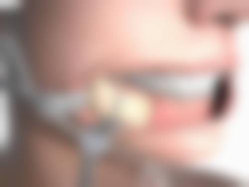 海薇玻尿酸价格是怎样的？