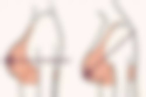 【南京迈锶医疗美容诊参考价格表：】