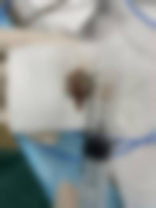 【杭州妤美医疗美容门诊部参考价格表:】