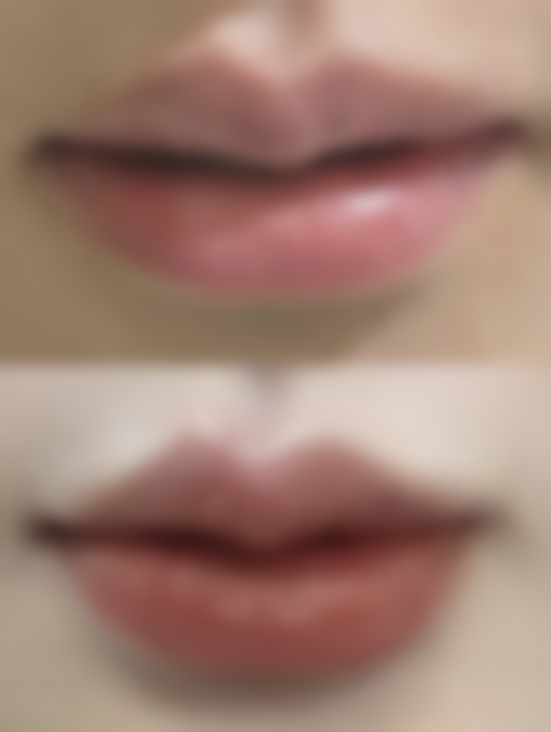 患者可通过电话或医院法定网站进行预约，具体联系方式和预约流程访问医院官网或联系医院客服。