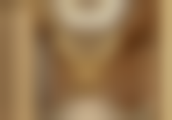 南通英莎医美开展该项目的实例展示