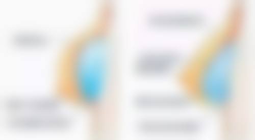 打完瘦脸针多长时间可以躺着