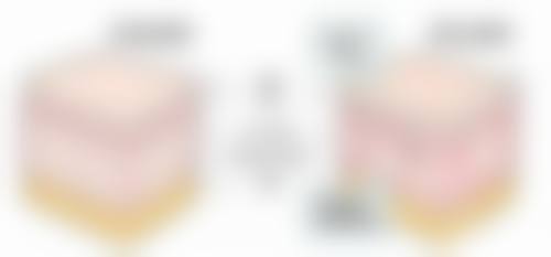 打了瘦脸针脸凹了怎么办？掌握这5种修复方法，让你的脸部恢复饱满，重回精致面容！ 