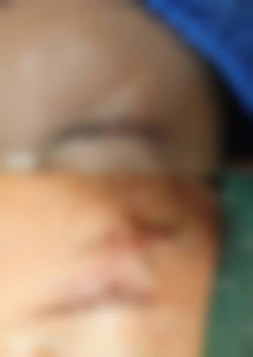 【成都爱尔丽医疗美容门诊部参考价格表：】