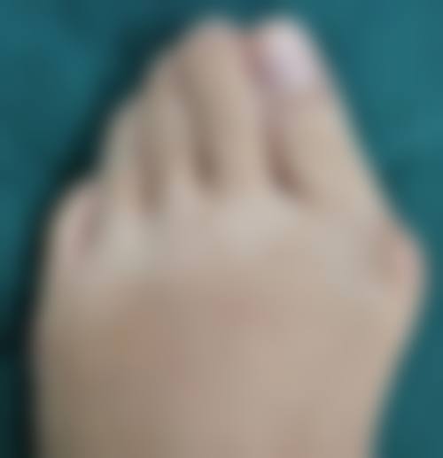 早泄的复杂性与治疗方向