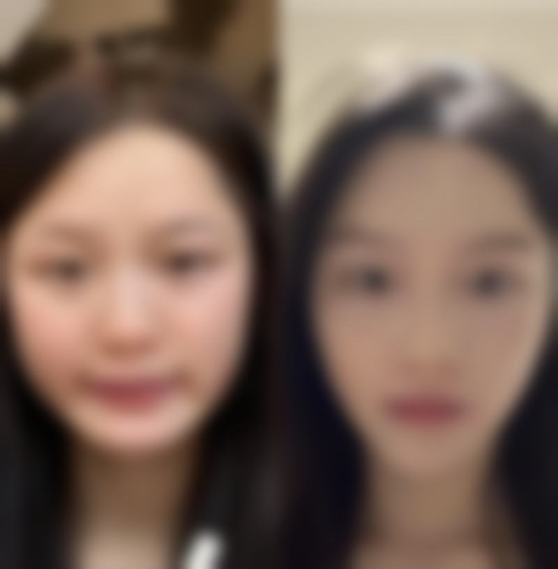 小孩嘴唇天包地