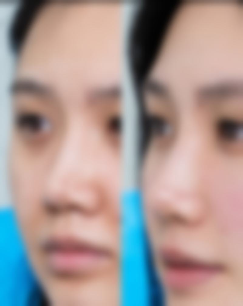 男生嘴唇太厚变薄小妙招