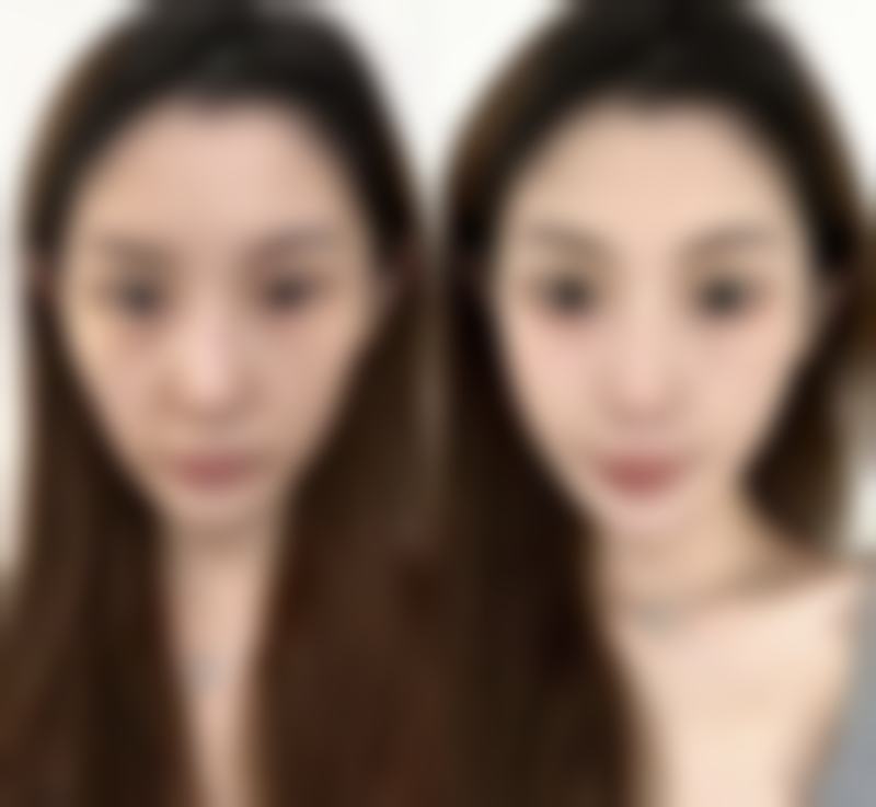 割了包皮能延长持久度吗？科学解析包皮环切对持久度的积极影响，3大关键因素揭秘真相！ 