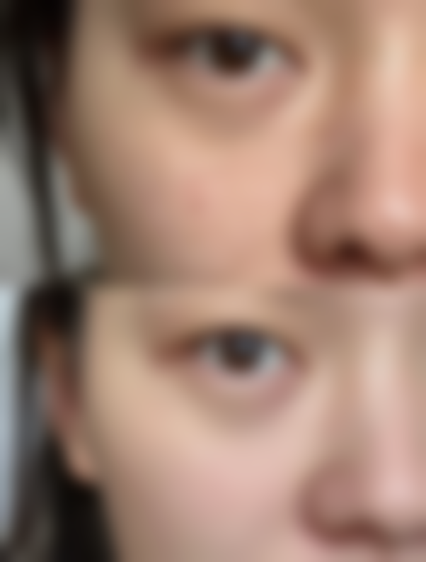 嘴巴有点厚怎么办图片解析