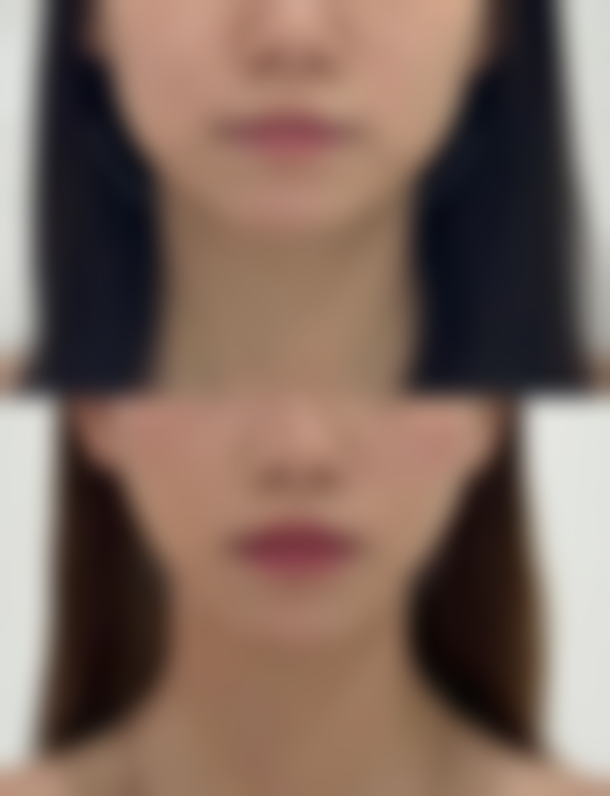 【扬州韩美医疗美容地址:】