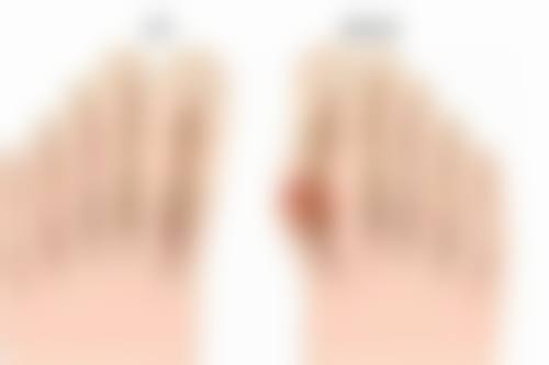 除皱针能延缓衰老吗