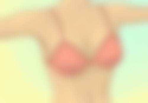 除皱针能提升面部吗图片