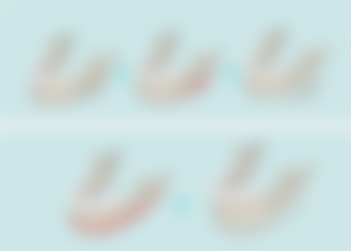 毛囊种植多久能长到更终成效