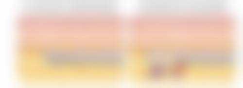 除皱针能去掉皱纹吗