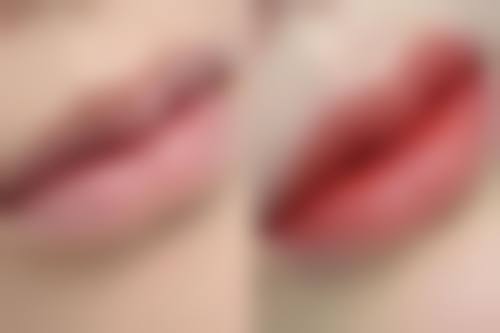 【韩国OYOUNG整形外科参考价格表:】