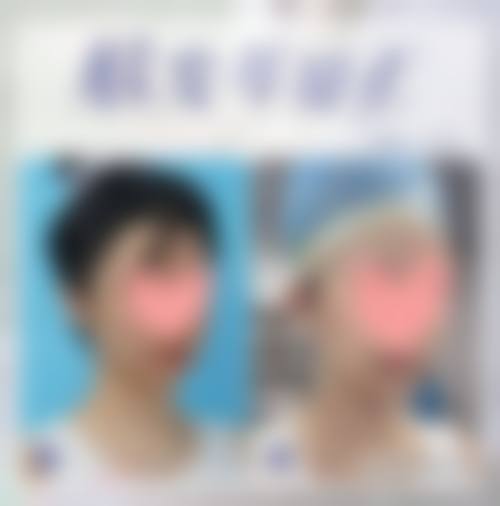 求美者可通过医院官网、电话或到院询问进行预约,医院会提供专精的询问服务,帮助顾客选择合适的整形项目。