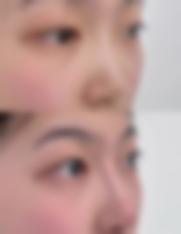 种植的毛囊多久可以存活啊