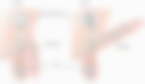 阴道紧缩术的优势