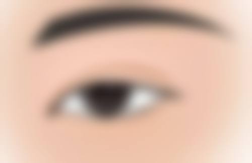 做过阴道紧缩手术还可以顺产吗？专家揭秘：多数情况仍有顺产可能，这些要点助你安全迎接新生命！ 