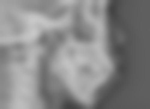 美白针都打什么