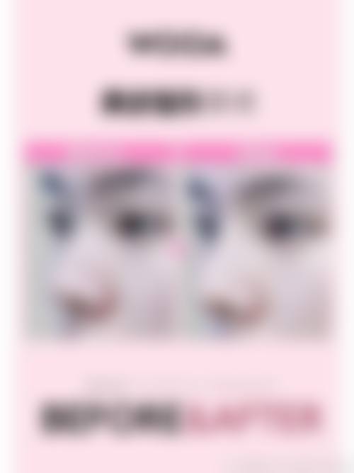 【泉州闽海皮肤病医院是正规的吗?】