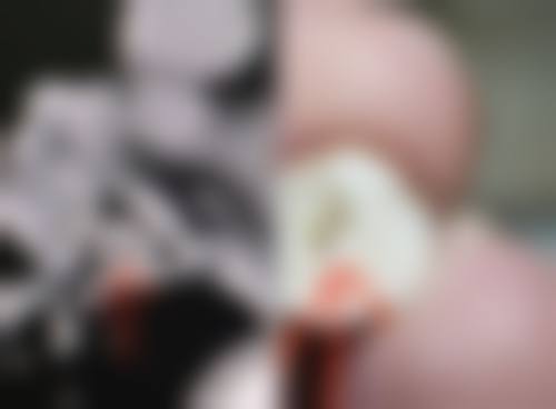 【泉州闽海皮肤病医院患者口碑评价：】