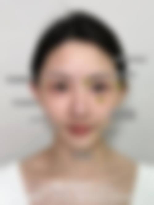 【薛媚医生擅长项目】