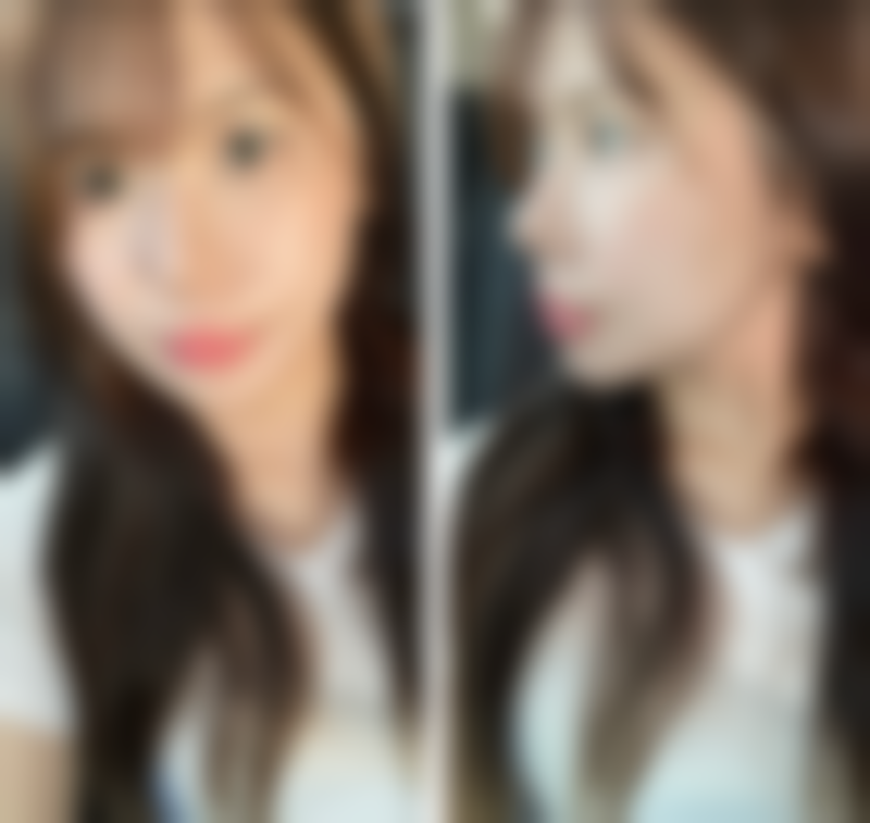 【上海梵丽医疗美容门诊部参考价格表：】