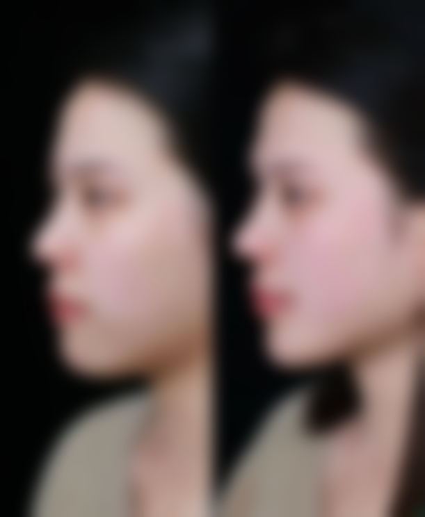 【薛媚医生口碑怎么样？】