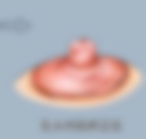 阴道紧缩术可以做吗