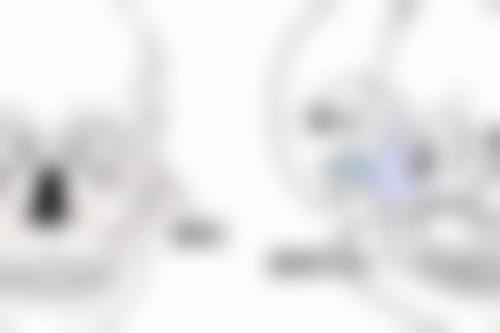 下巴后缩怎么纠正？揭秘医美四大有效方法，重塑精致脸型，让你告别面部凹陷！ 